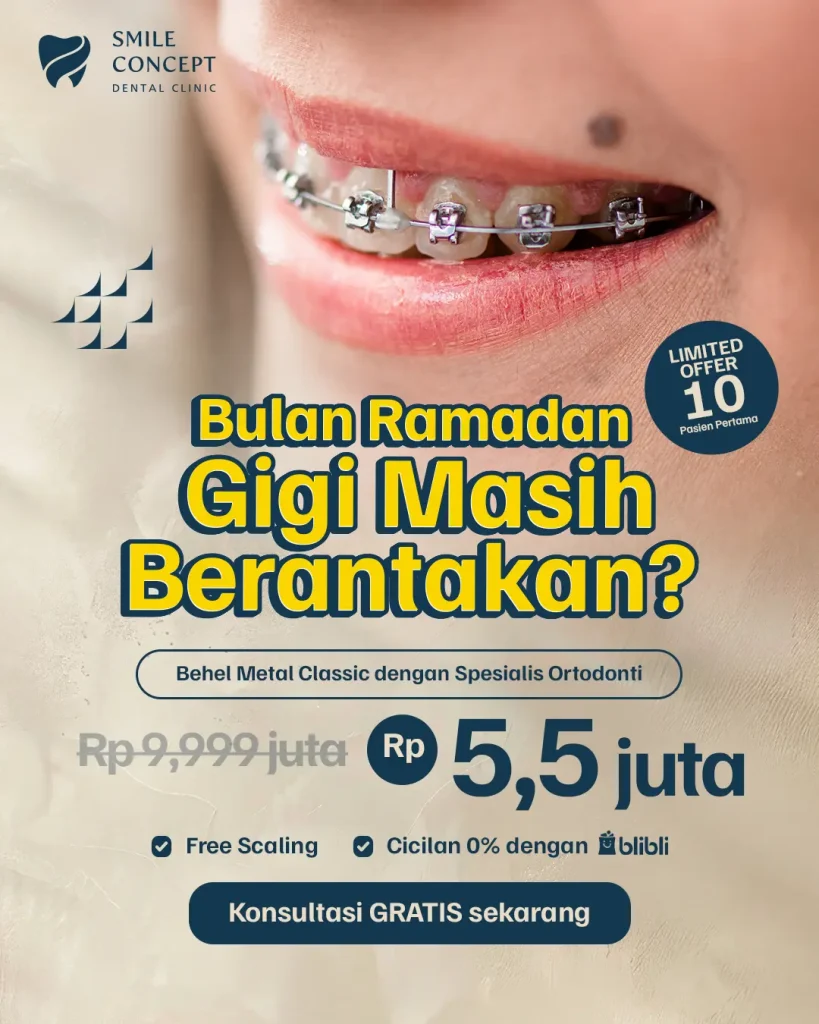 Iklan Smile Concept Dental Clinic: Promo Behel Metal Classic dengan Spesialis Ortodonti Rp 5,5 juta (dari Rp 9,999 juta), termasuk Free Scaling dan Cicilan 0% blibli. Berlaku untuk 10 pasien pertama